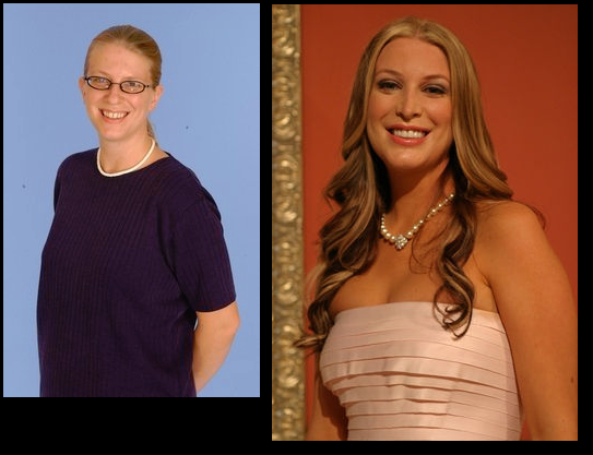 Fox used to have an absurd show called “The Swan” where ‘ugly’ women were given loads of plastic surgery and then competed against each other in a beauty contest. These are some of the before and afters.