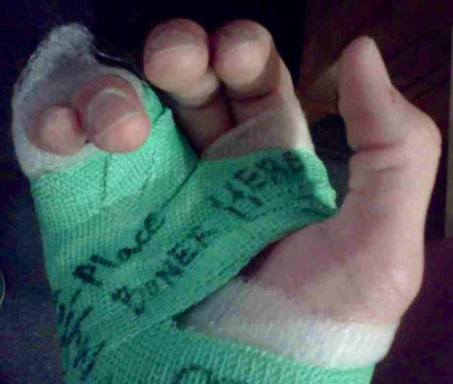 I'm not allowed to sign casts anymore