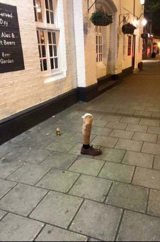 Ever been so drunk, you left your leg outside the pub?