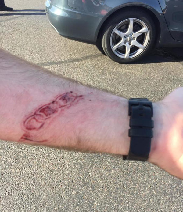 Was in a car accident today, as a souvenir all I got was this lousy Audi logo burnt into my arm (from the front of the steering wheel)