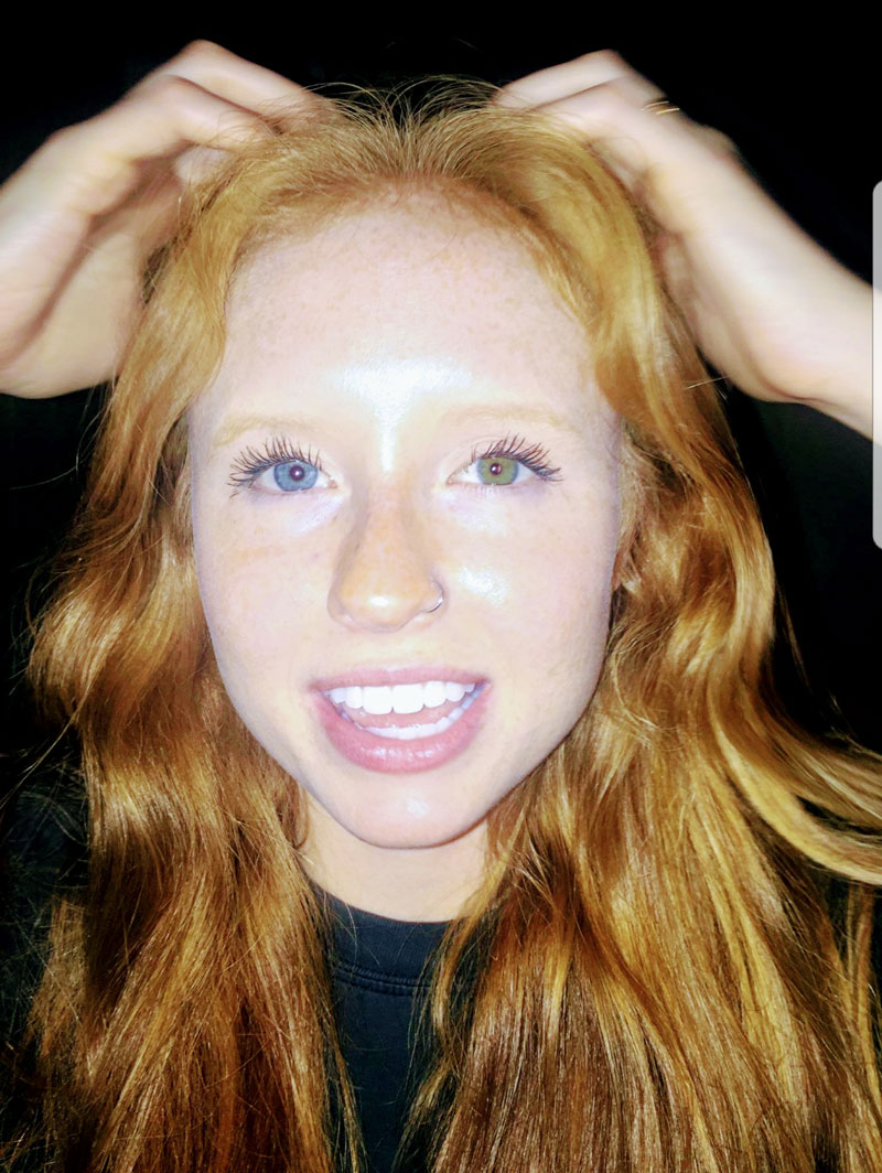 My sister is a ginger and has heterochromia. A genetic masterpiece