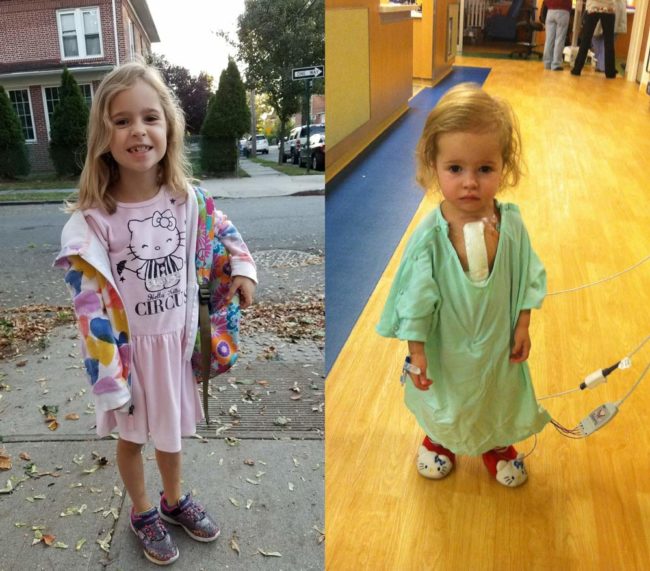 The open-heart surgery to fix her Atrial Septal Defect was 5 years ago today