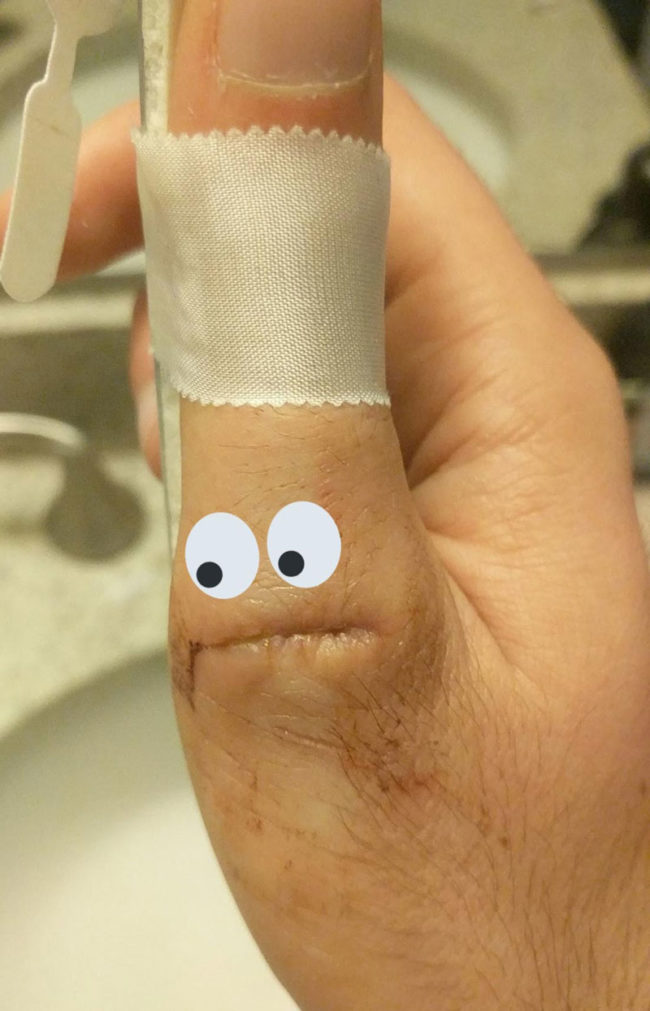 Cut my thumb the other day... Haven't heard a word from it since