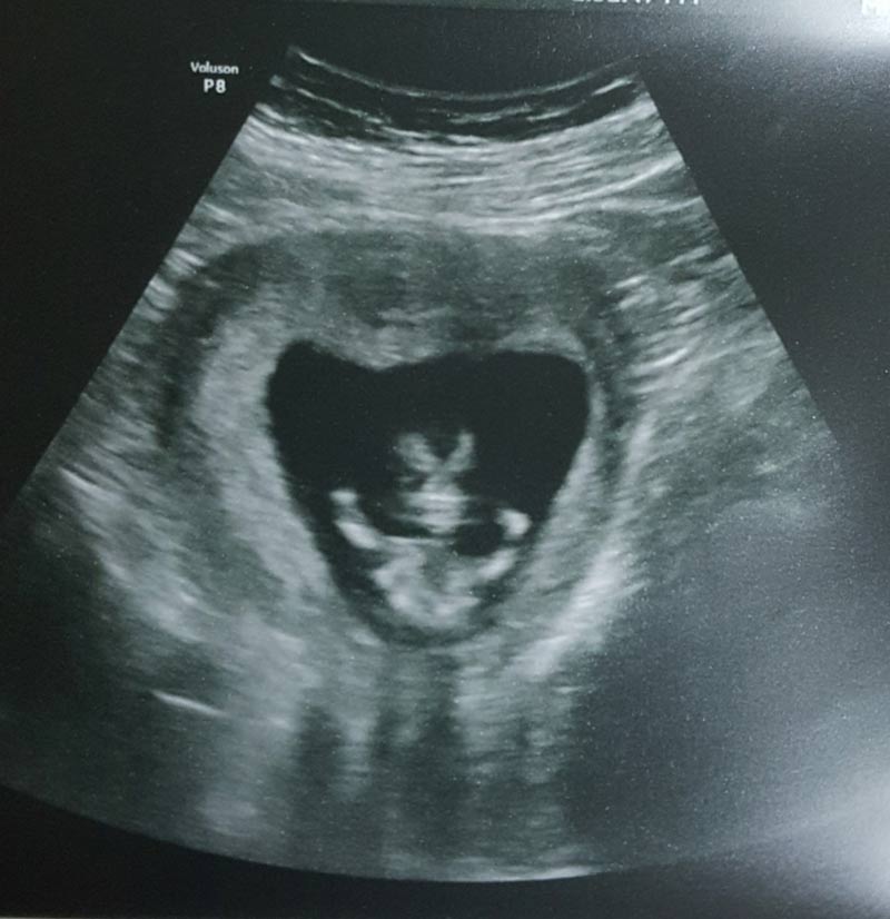 My wife had her first ultrasound today. Our child looks like an evil villain set on taking over the world