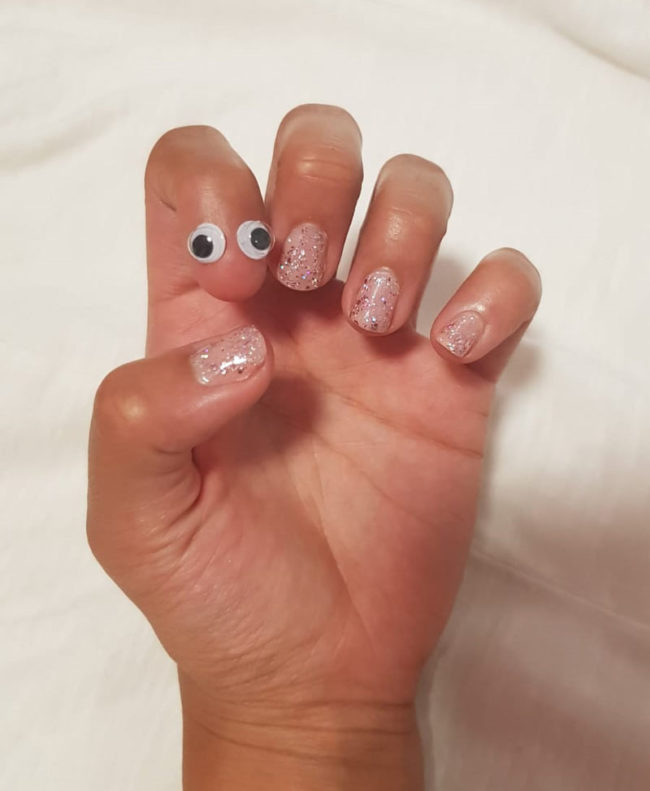 My girlfriend was born without a nail on a finger. So due to popular demand, we put google eyes on it!