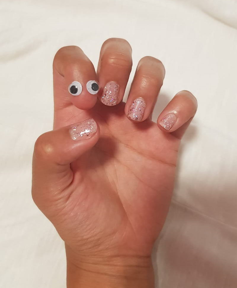 My girlfriend was born without a nail on a finger. So due to popular demand, we put google eyes on it!