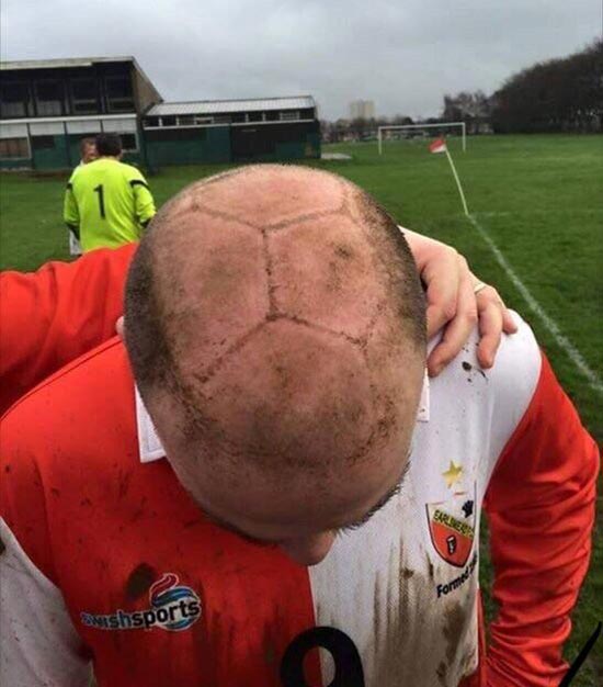 Bald man hit in the head by soccer ball