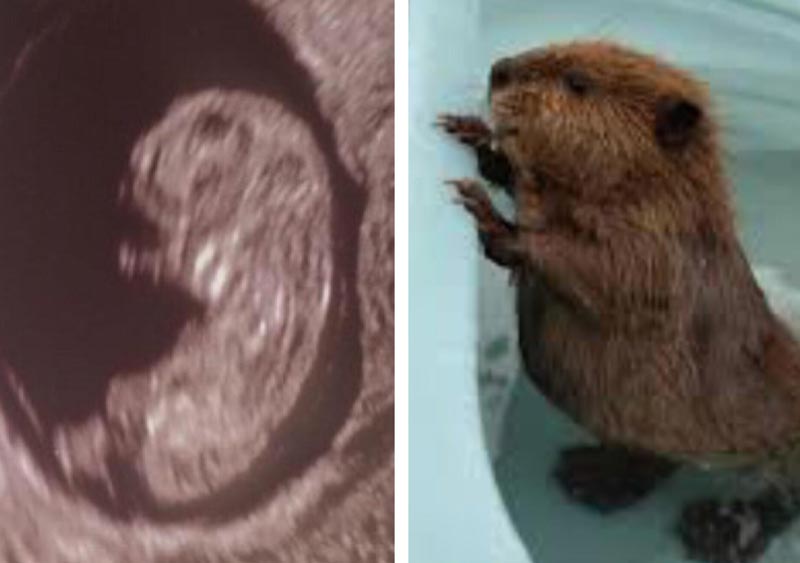 My sister’s baby sonogram reminds me of a beaver
