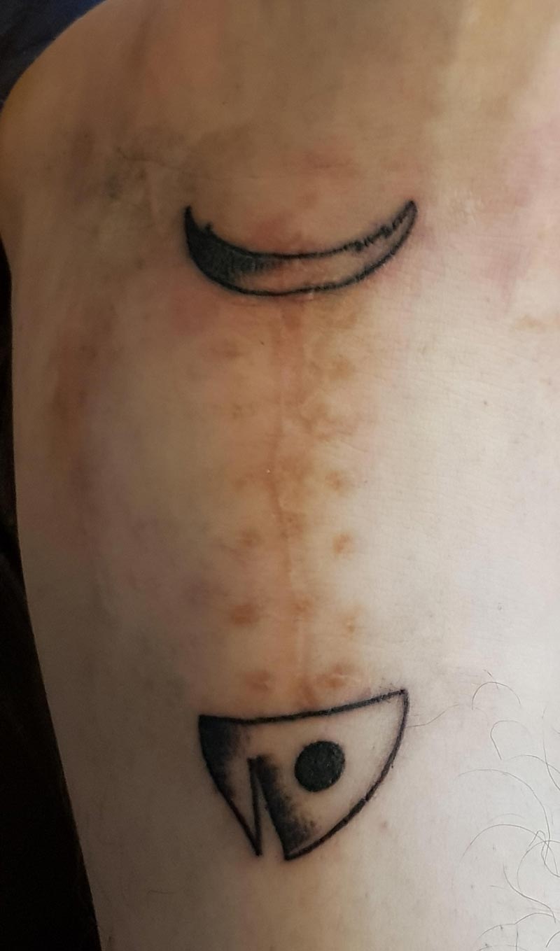I have had multiple ankle surgeries. Today I got a tattoo to make my scar a little sillier