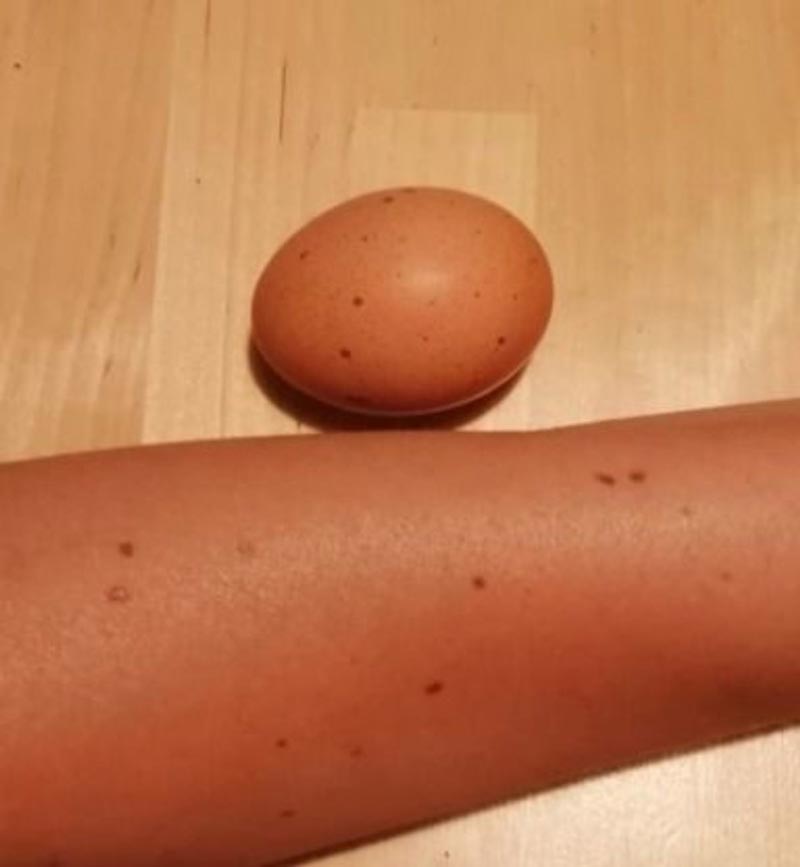This egg looks like my skin