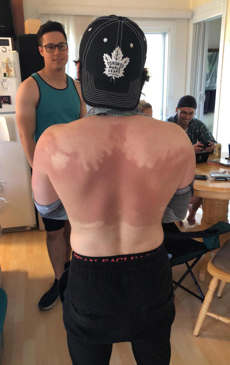 My friend refused to ask for help with putting sunscreen on, this is the result