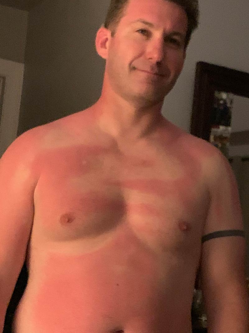 Asked my wife to apply my sunscreen