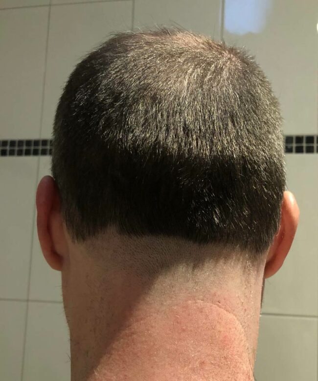 I asked my wife to tidy up my neck with the clippers... yes we are still married