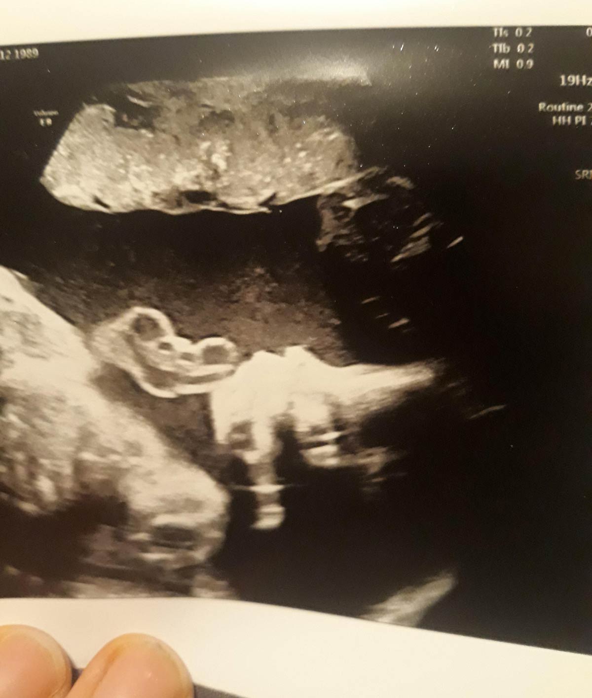 Went for a baby scan today, we already have a boy and a girl, the third is going to be a... dinosaur?!