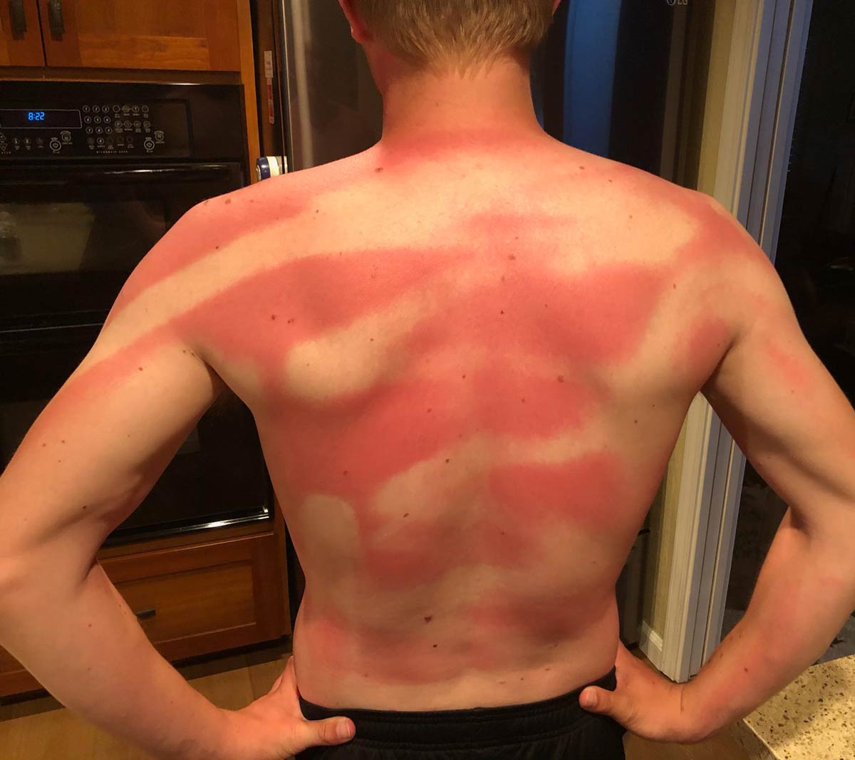 My wife put sunscreen on my back at the beach today.. Twice!