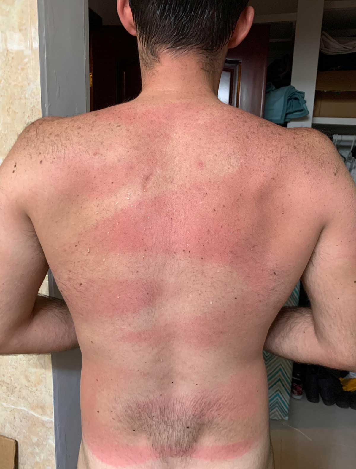 Wife helped spray sunscreen on my back..