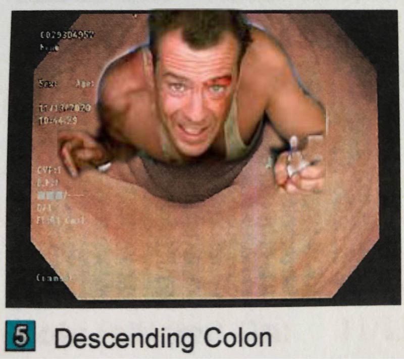 Had my first colonoscopy and was given a commemorative pic that I photoshopped for this year’s Christmas card. Wife vetoed it