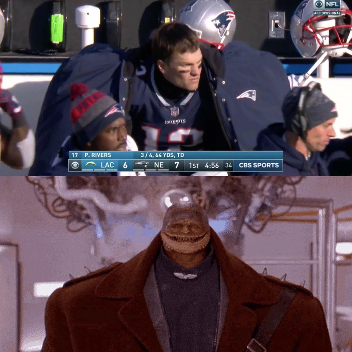 What I see when NFL players wear those coats