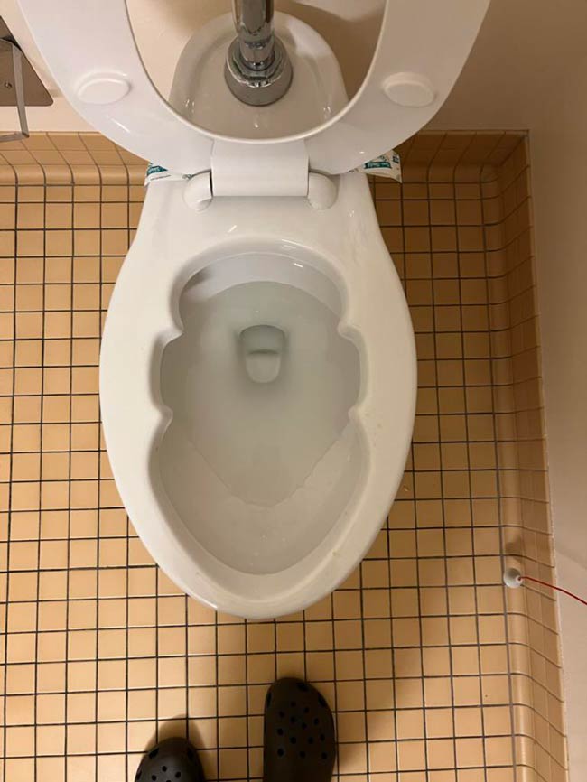 Toilet bowl in hospital looks like Thanos' head
