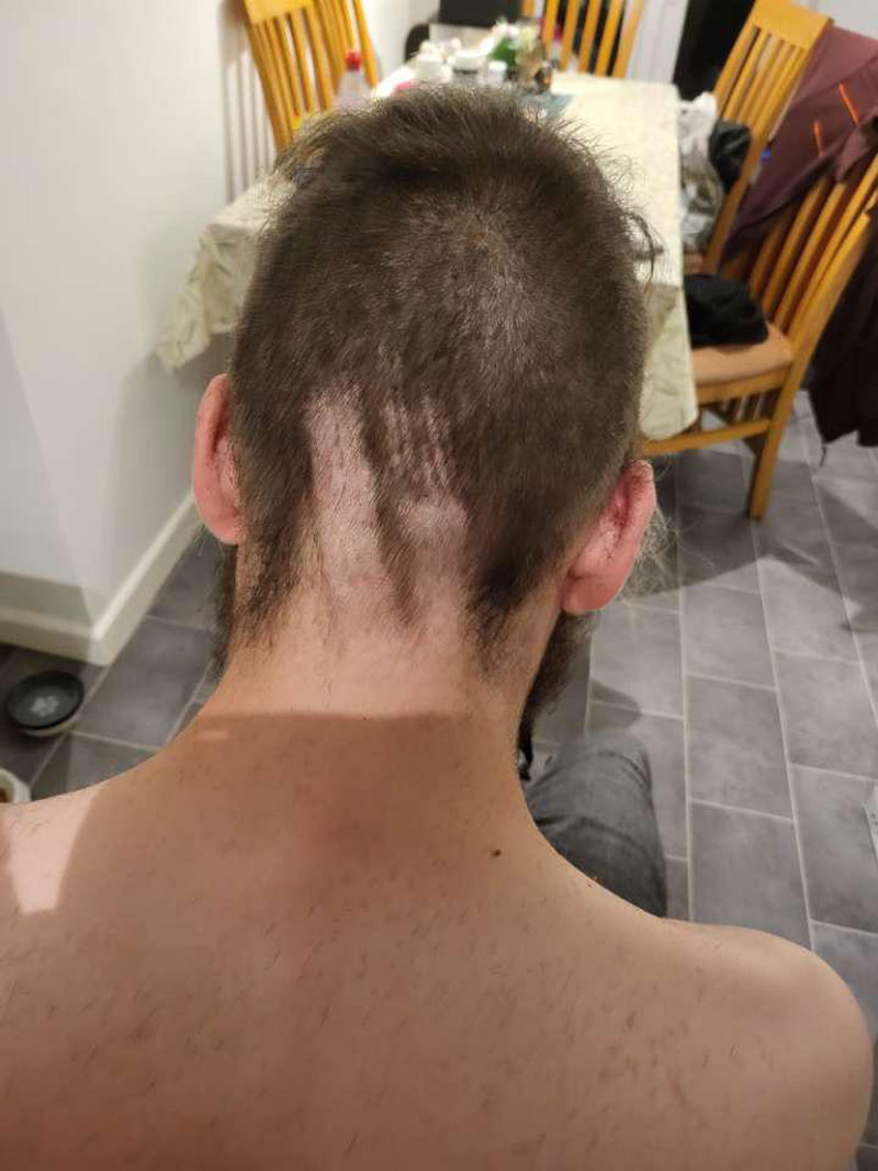 Girlfriend was helping cut my hair, she was doing a fantastic job until I heard a gasp