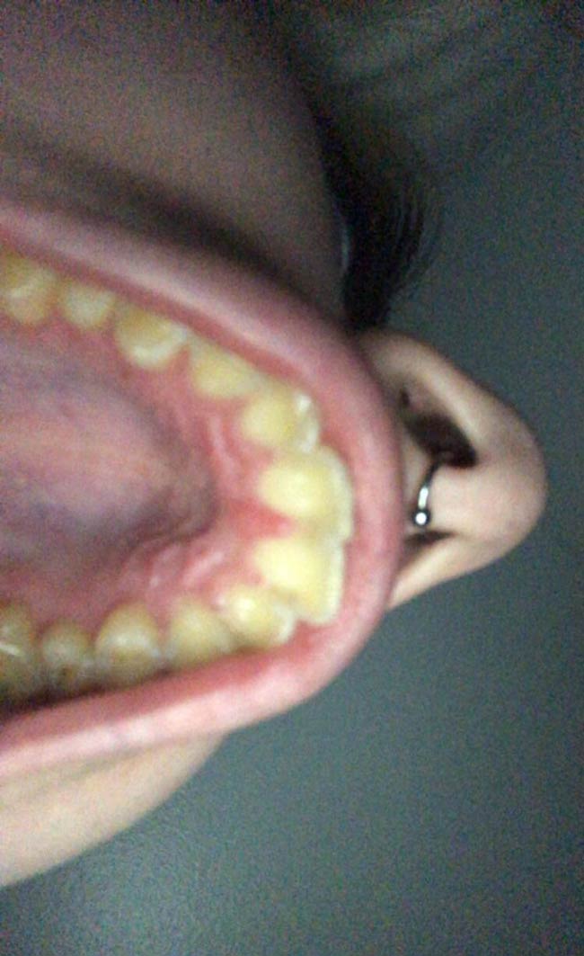 Got super high and was convinced something was wrong with the roof of my mouth. Woke up the next day and realized I had sent this photo to an unfortunate amount of people