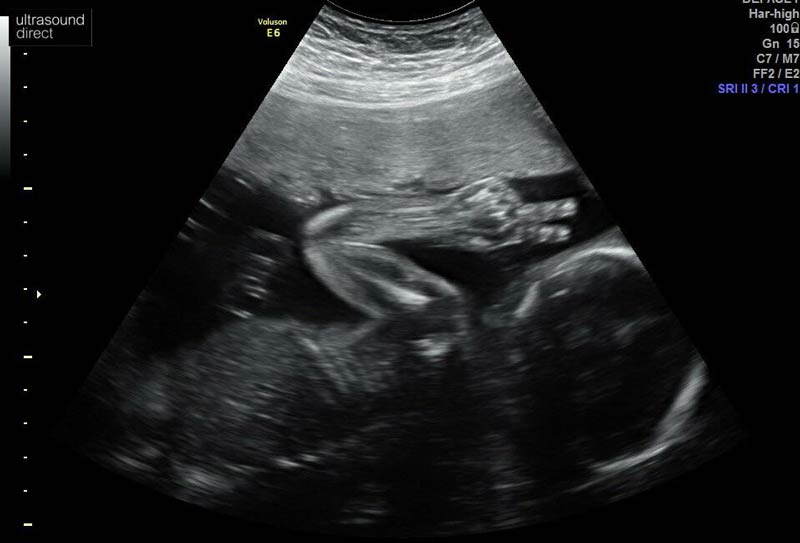 My first child - 23 week ultrasound and already vibing!