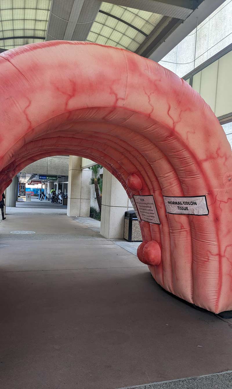 There was a butthole tunnel to walk through at my hospital today, for colon health awareness