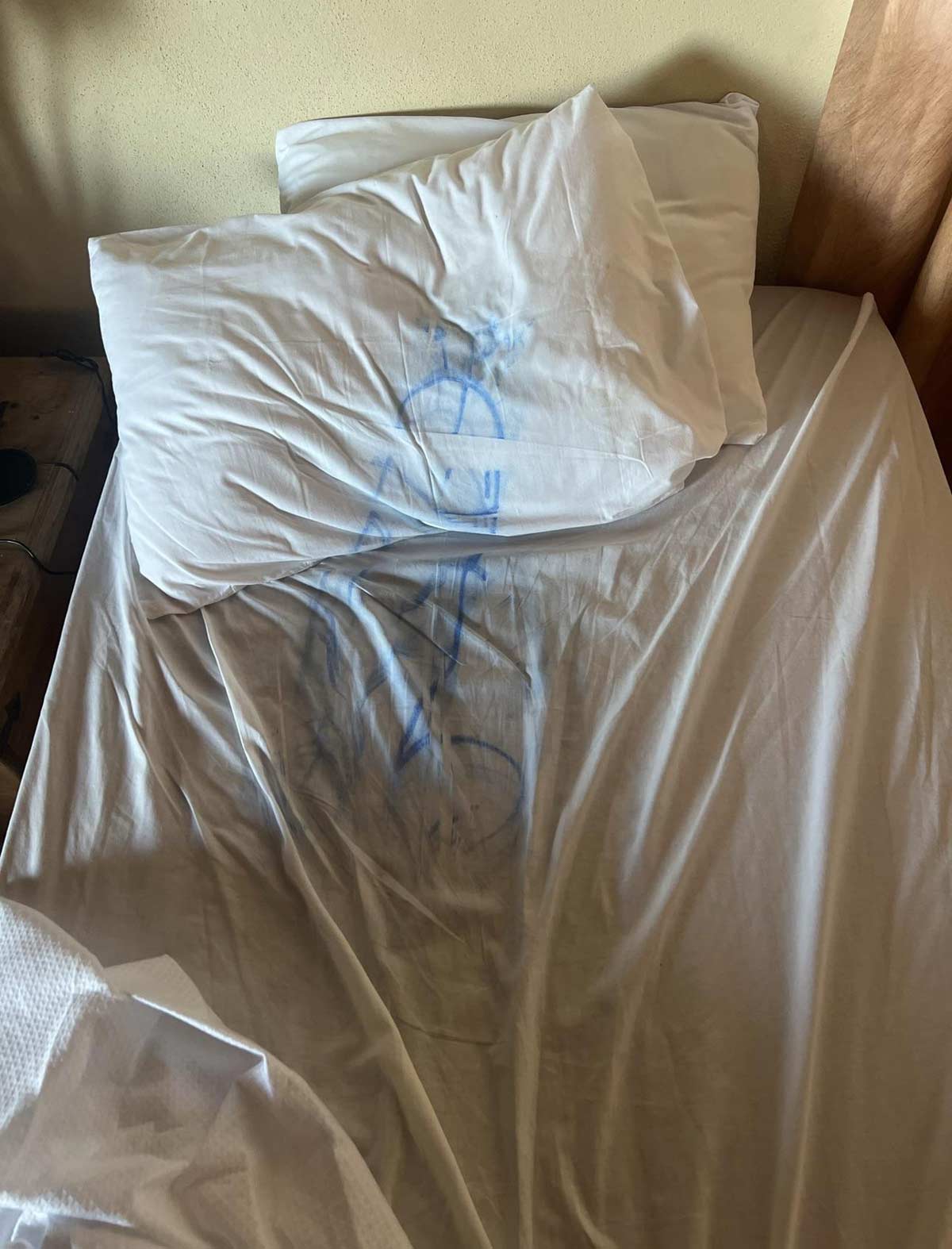 My buddy drew a dick on my back in sharpie while we were at a hotel in mexico, this is what I woke up to