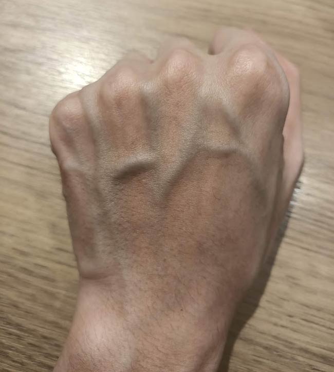 My veins spell HA
